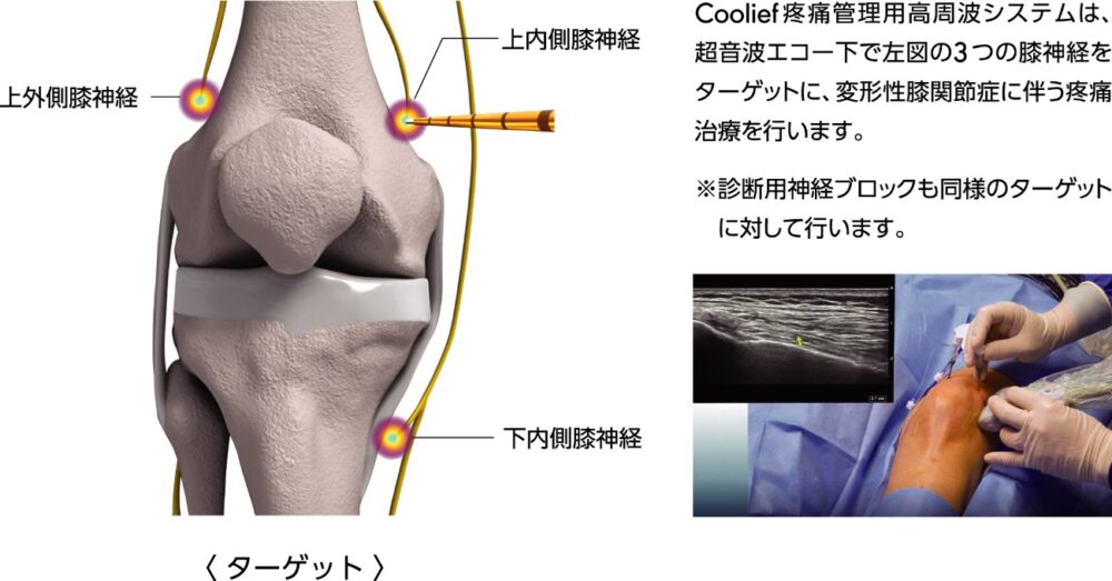 治療の流れ